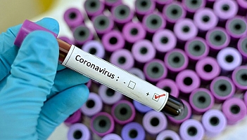 Poradnik: Jak uchronić się przed koronawirusem w podróży?